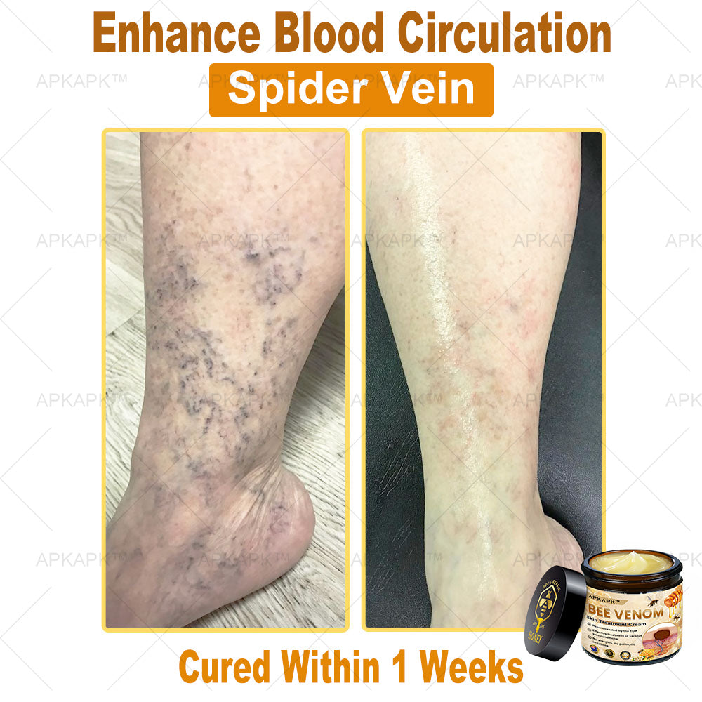 𝐀𝐏𝐊𝐀𝐏𝐊™ Bee Venom Comprehensive Cream (Suitable for all ages & TGA recommends)🔥🔥