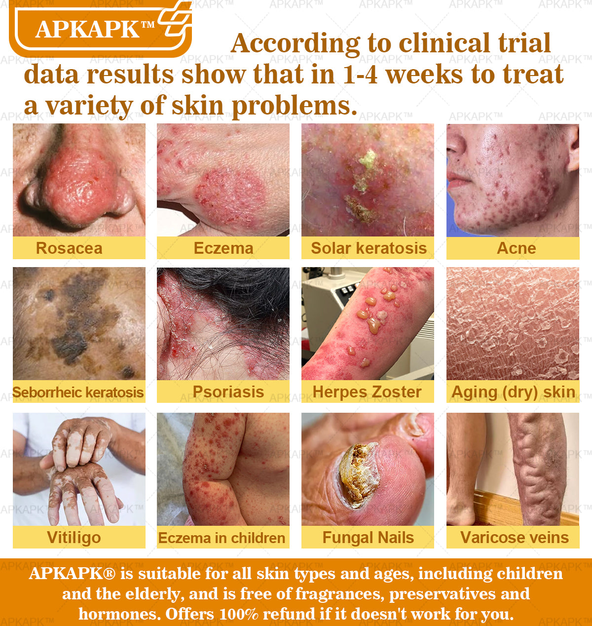 𝐀𝐏𝐊𝐀𝐏𝐊™ Bee Venom Comprehensive Cream (Suitable for all ages & TGA recommends)🔥🔥