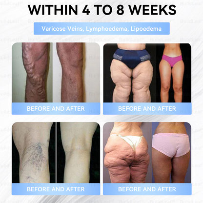 𝑶𝒇𝒇𝒊𝒄𝒊𝒂𝒍 𝑺𝒕𝒐𝒓𝒆|🏥𝐵uil𝗱𝐿ea𝐟® 𝑮𝐋𝑃-1 Slim & Firm 𝑁ano 𝑀icroneedle 𝑃atch with Collagen,Turmeric&Matrixyl 3000 丨Obesity,Cardiovascular Diseas, Diabetes, Sleep Apnea, Joint Problems and More