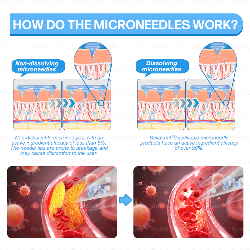 𝑶𝒇𝒇𝒊𝒄𝒊𝒂𝒍 𝑺𝒕𝒐𝒓𝒆|🏥𝐵uil𝗱𝐿ea𝐟® 𝑮𝐋𝑃-1 Slim & Firm 𝑁ano 𝑀icroneedle 𝑃atch with Collagen,Turmeric&Matrixyl 3000 丨Obesity,Cardiovascular Diseas, Diabetes, Sleep Apnea, Joint Problems and More