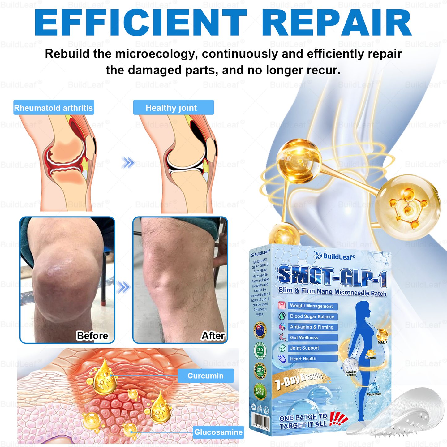 𝑶𝒇𝒇𝒊𝒄𝒊𝒂𝒍 𝑺𝒕𝒐𝒓𝒆|🏥𝐵uil𝗱𝐿ea𝐟® 𝑮𝐋𝑃-1 Slim & Firm 𝑁ano 𝑀icroneedle 𝑃atch with Collagen,Turmeric&Matrixyl 3000 丨Obesity,Cardiovascular Diseas, Diabetes, Sleep Apnea, Joint Problems and More